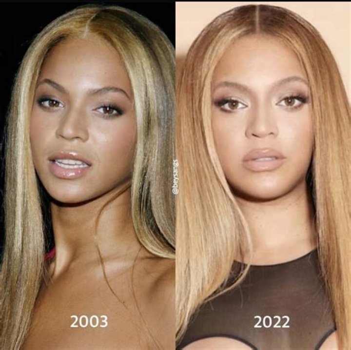 Did Beyonce Get A BBL | Before And After Photos